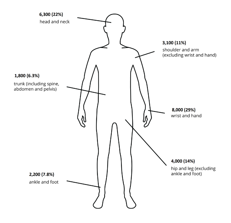 The visualisation features an outline of a person with labels for body parts accounting for hospitalisation due to contact with living things. Injuries to the wrist and hand accounted for the most hospitalisations while the trunk (including spine, abdomen and pelvis) accounted for the fewest.