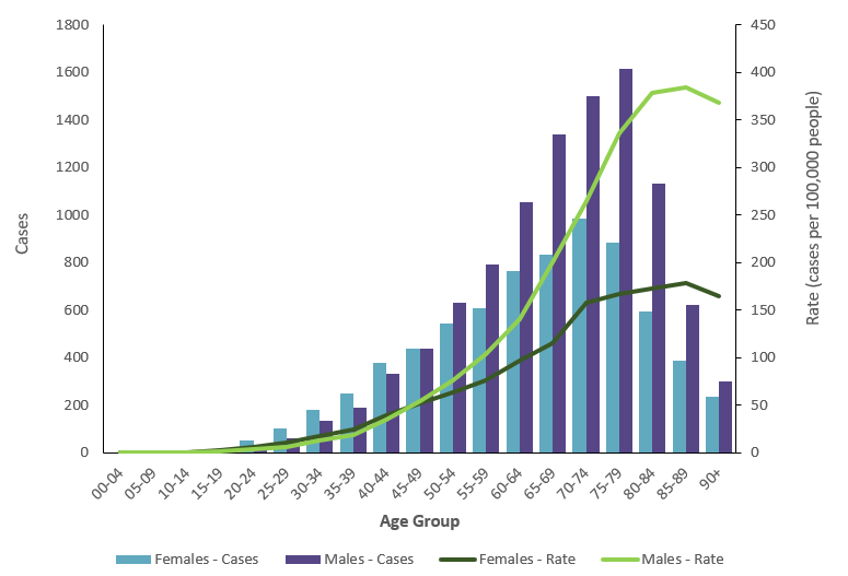 Graph shows the incidence of melanoma among males and females is similar until 50 years of age, where rates in males begin increasing more rapidly than for females.