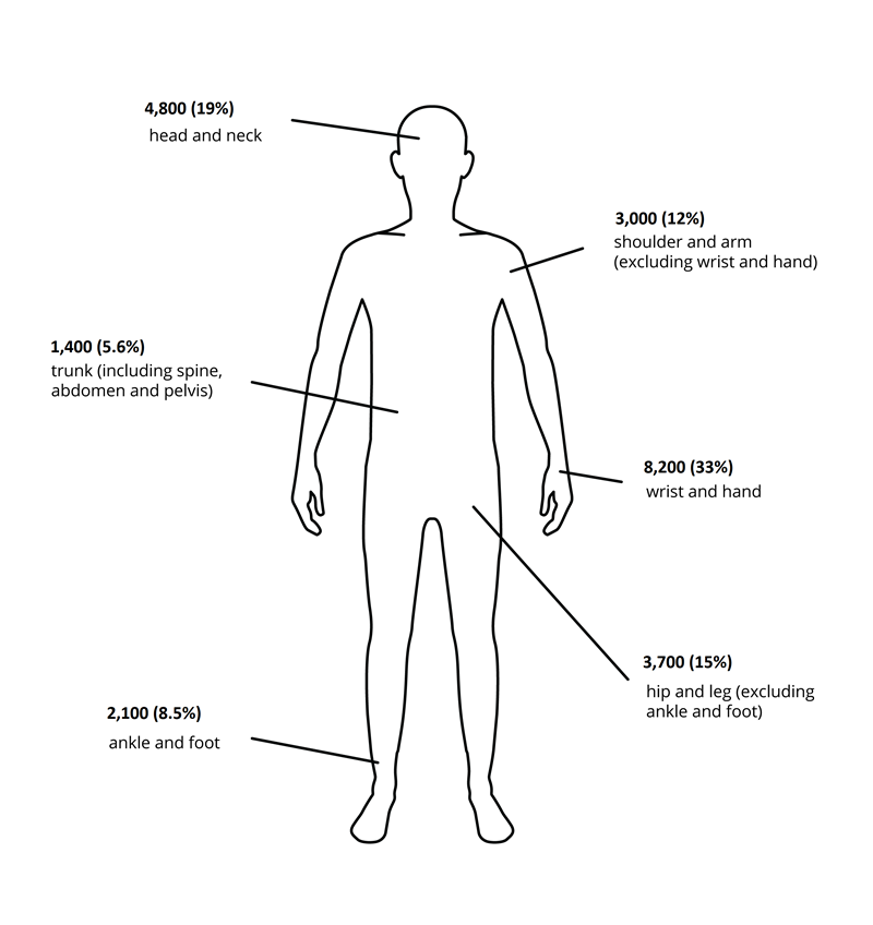 The visualisation features an outline of a person with labels for body parts accounting for hospitalisation due to contact with living things. Injuries to the wrist and hand accounted for the most hospitalisations while the trunk (including spine, abdomen and pelvis) accounted for the fewest.