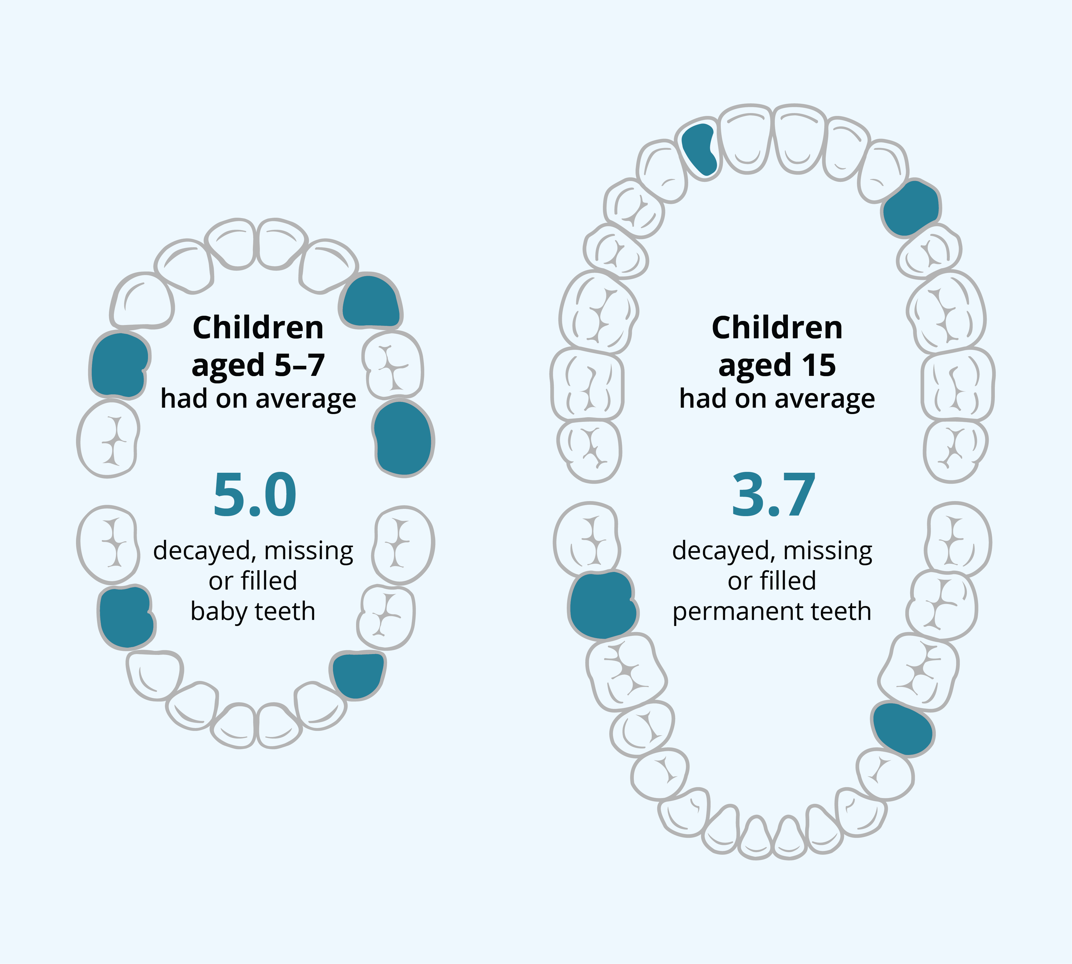 The infographic shows that First Nations children aged 5–7 in the NTRAI OHP had on average 5 decayed, missing or filled baby teeth in 2022. For those aged 15 the average was 3.7 decaying, missing, or filled permanent teeth in 2022. 