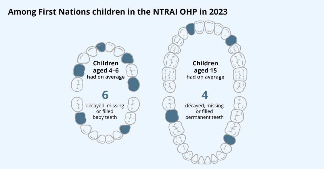 The infographic shows that First Nations children aged 4–6 in the NTRAI OHP had on average 6 decayed, missing or filled baby teeth in 2023. For those aged 15 the average was 4 decaying, missing, or filled permanent teeth in 2023.
