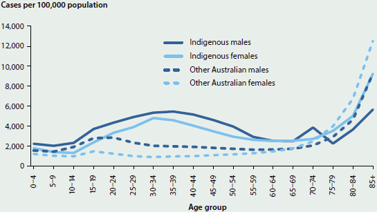 Line chart showing the number per 100000 population of injury hospitalisations, by Indigenous status, sex, and age group in 2013-14. There is a sharp increase for all demographics after age 70, but for most of life Indigenous males are the most affected group. There were around 6000 injury hospitalisation cases per 100000 people for Indigenous males aged 35-39.