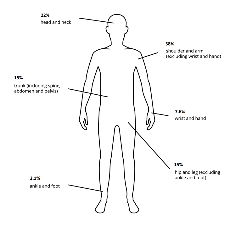Outline of a person with body regions labelled, marked with the percentage of hospitalised injuries for each region