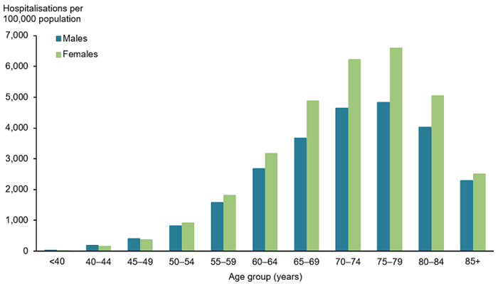 This vertical bar chart compares the rate (per 100,000 population) of hospitalisations for osteoarthritis, across various age groups by sex, in 2017–18. The rate of hospitalisations was highest in the 75–79 age group for both males (4,826) and females (6,589), and lowest in the ≤40 age group for both males (25) and females (17).