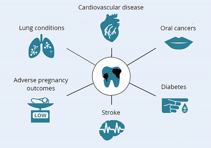 Figure 1 demonstrates the links between poor oral health and chronic diseases such as cardiovascular disease, lung conditions, oral cancers, adverse pregnancy outcomes, stroke and diabetes.